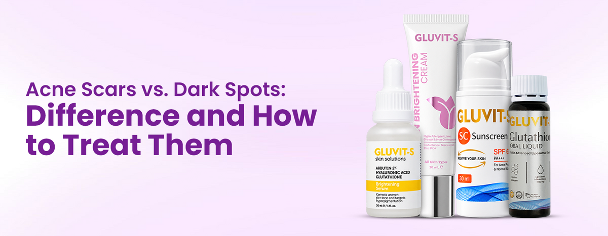 Acne Scars vs. Dark Spots: Difference and How to Treat Them